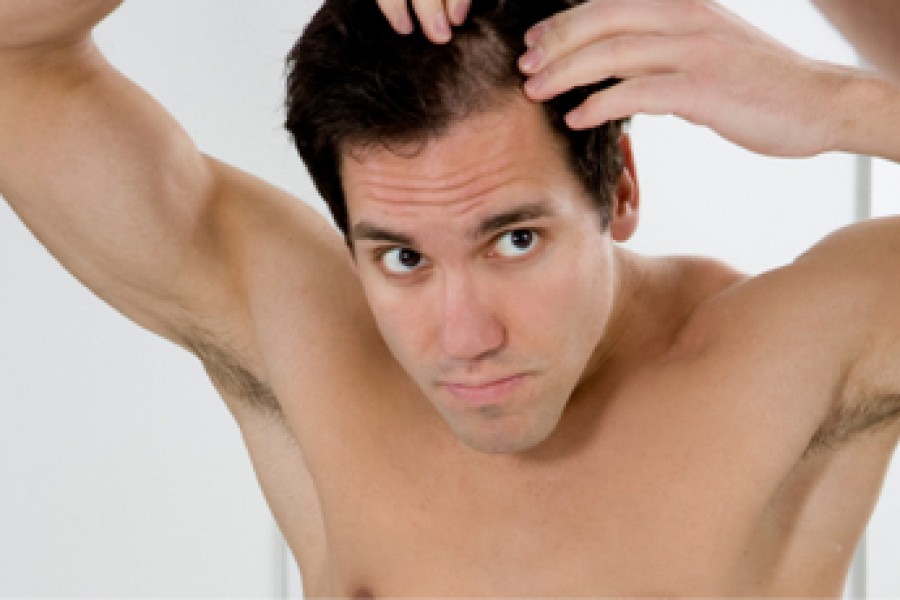 Nutritional  Deficiency leads to hair loss!