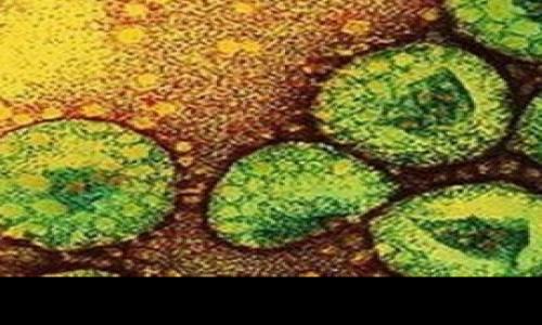 Corona virus: Egypt announces the death of a woman suspected of being infected with the disease